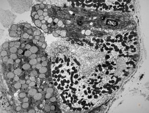 normal mucosa - stomach - parietal cell normal mucosa - stomach - parietal cell